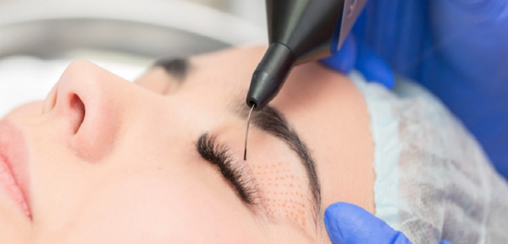 بهترین کلینیک زیبایی در شرق تهران در درمان پوست با پلاسماجت